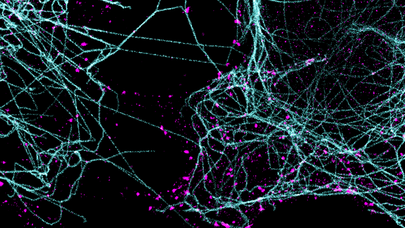 多色复用超分辨率成像的静止图像。微管蛋白-聚合成长链-用青色标记。网格蛋白-组装成球形晶格-品红。