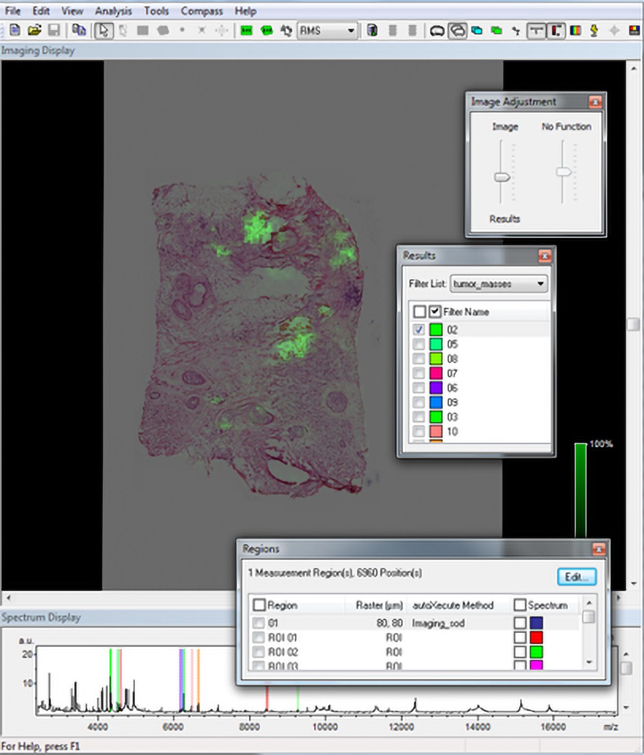 MALDI Imaging data overlaid with virtual microscopic slide in flexImaging