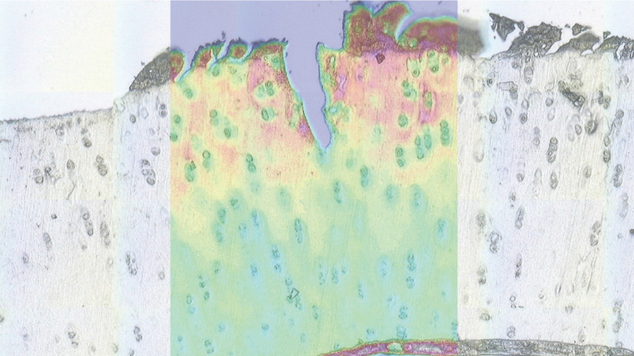 该图像显示了软骨受损的组织部分的微观图像。低对比度图像通过叠加的红外图像增强，显示蛋白质，脂质和碳水化合物。